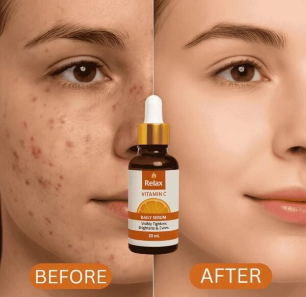 Relax Vitamin C Daily Face Serum – Brightening, Anti-Aging & Hydrating Formula For Healthy Radiant Skin (30ml) - Image 3
