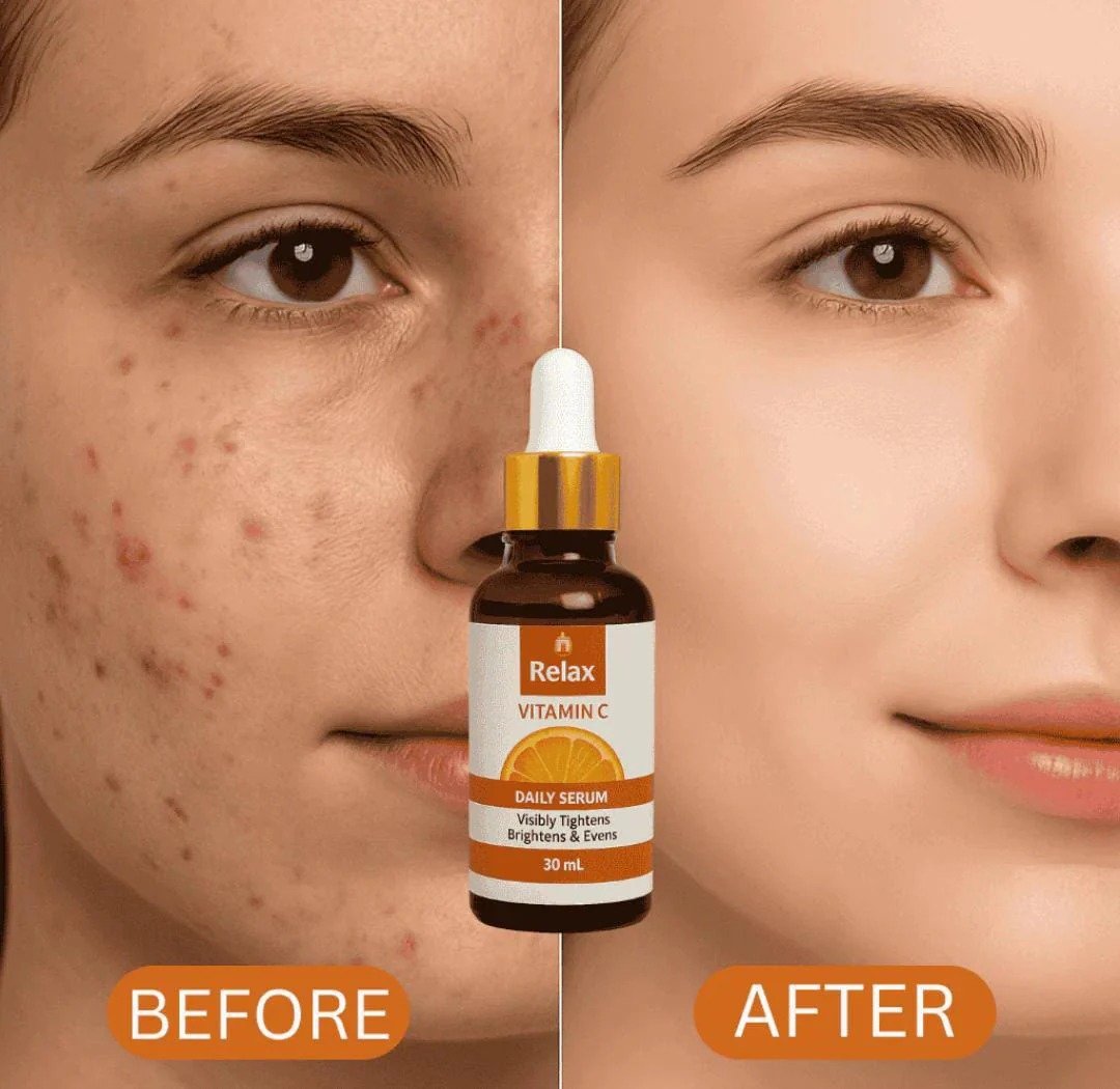 Relax Vitamin C Daily Face Serum – Brightening, Anti-Aging & Hydrating Formula For Healthy Radiant Skin (30ml) - Image 3